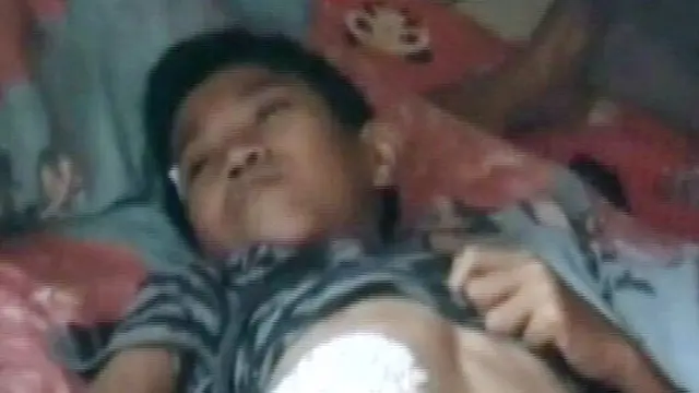 Ditolak RS, Tumor Rizki hanya Diobati Singkong Karet