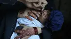Seorang petugas kesehatan memberikan vaksin polio kepada seorang anak di lingkungan Lahore, Pakistan, Senin, 2 Oktober 2023. (AP Photo/K.M. Chaudary)