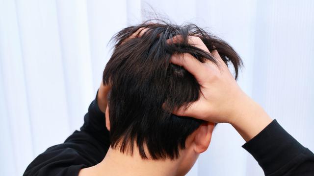 Kulit Kepala Gatal Pada Pria, Ketahui Penyebab dan Cara Mengatasinya yang Tepat