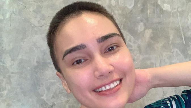 Karena Kemoterapi Feby Febiola Dapatkan Model Rambut Impian News Entertainment Fimela Com