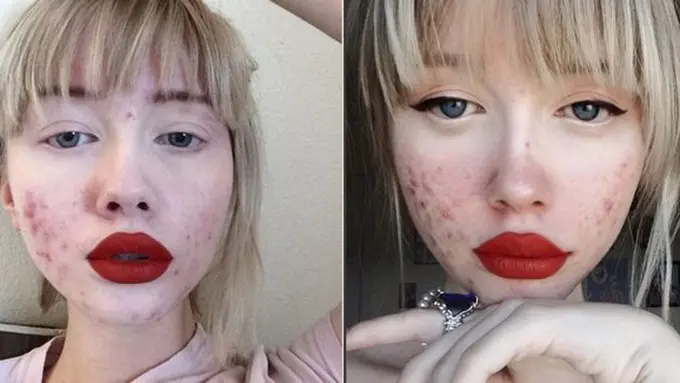 Copyright: instagram/pigss