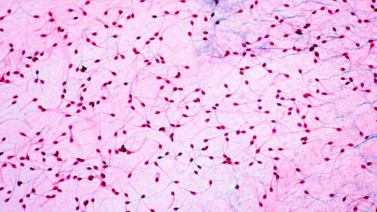 Sperma Berenang Lambat