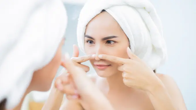 komedo hitam menumpuk