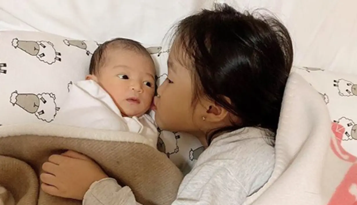 Melalui akun instagram miliknya, Ruben Onsu bercerita bahwa Thalia selalu mencium kening sang adik. (Liputan6.com/IG/ruben_onsu)