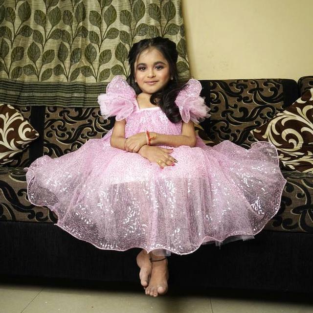 Alami Kondisi Langka, Gadis 19 Tahun Ini 'Terperangkap' di Tubuh Anak Kecil