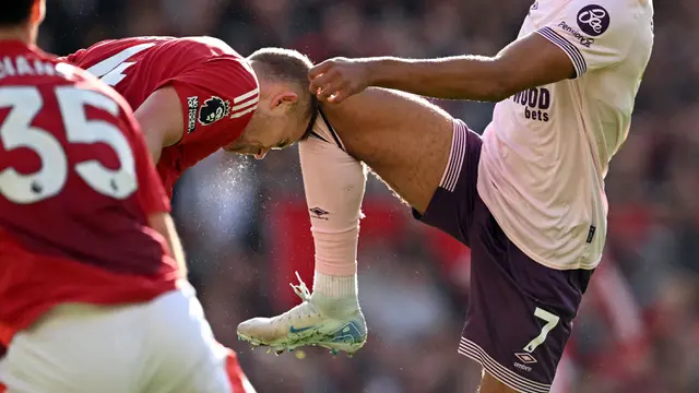 Foto: Pengorbanan Berdarah-Darah Matthijs de Ligt saat Bawa MU Menang Comeback atas Brentford di Liga Inggris