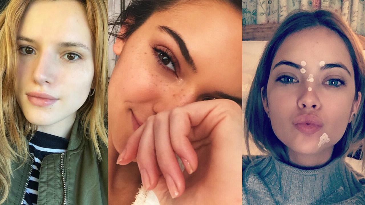 Lihat 10 Selebritas Dunia yang Juga Berjuang dengan Jerawat