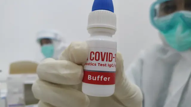 Alat rapid test produksi dalam negeri