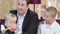 [VIDEO] Penyakit Paling Aneh di Dunia Serang Bayi 2 Tahun