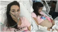 Cherish-Rose Lavelle, gadis 11 tahun membuat bingung para dokter karena mulanya dianggap hamil. ternyata ada tumor dalam ovariumnya. Source: Meaww