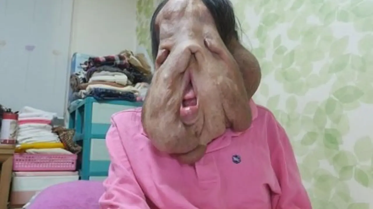 Wajahnya 'Mencair', Wanita Korea Ini Raih Simpati Netizen