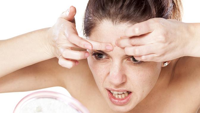 Letak Jerawat Ungkap Masalah Kesehatan Anda Beauty Fimela Com
