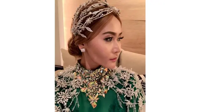 Biaya Suntik Kecantikan Hampir Rp 100 Juta, Ini 6 Potret Inul Tampil Glowing