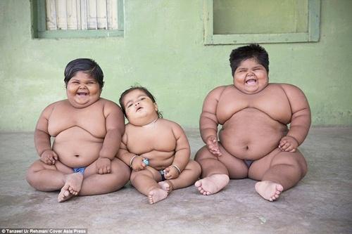 Ketiga buah hati Rameshbhai yang mengalami obesitas | Photo: Copyright asiantown.net