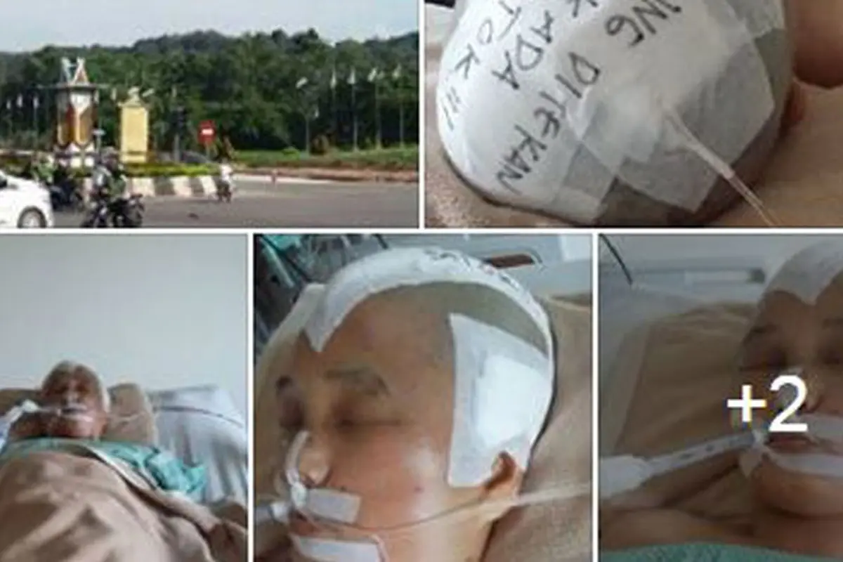Wanita Pecah Tempurung Kepala Diduga Korban Tabrak Lari Polisi