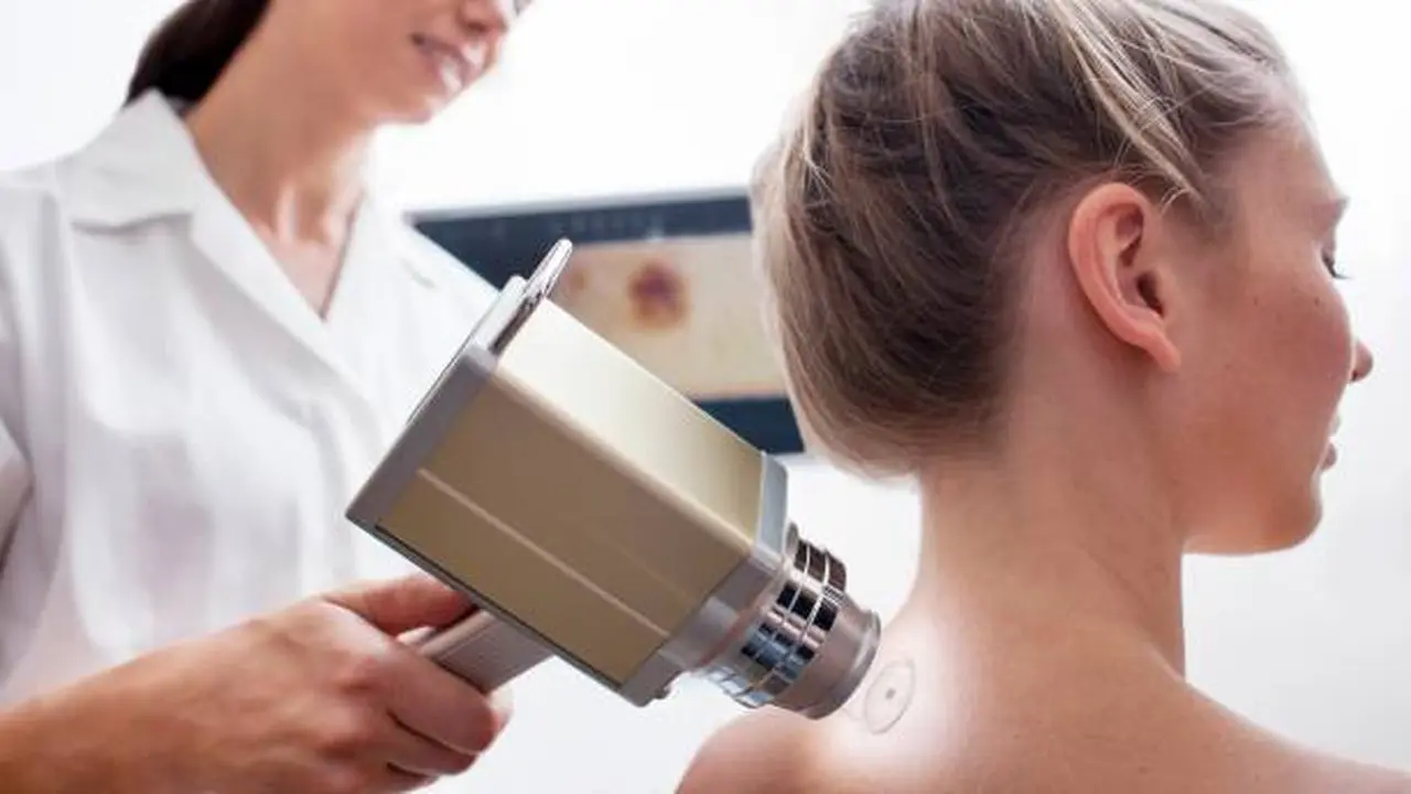 5 Tanda Tahi Lalat di Hidung: Makna dan Implikasinya, Fakta Mengejutkan