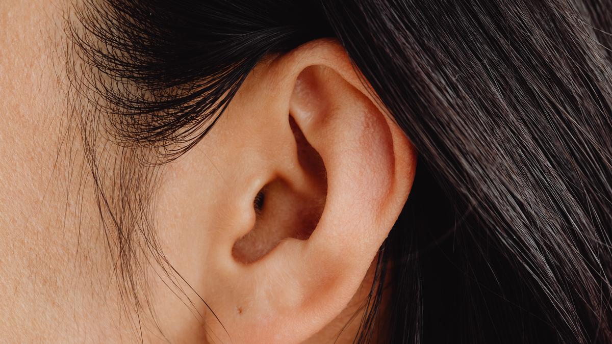 Kenapa telinga berdenging sebelah kanan