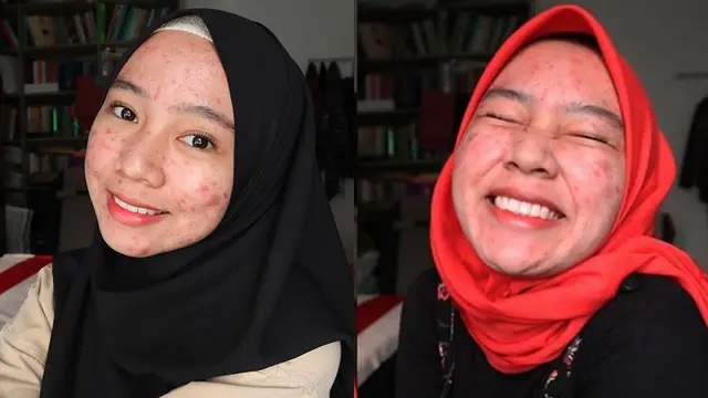 Percaya Diri Unggah Foto Berjawat di Medsos, Perempuan Ini Viral dan Menginspirasi