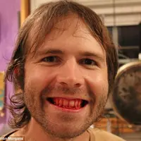 Selama 7 tahun, hanya daging mentah yang dikonsumsi oleh laki-laki ini.