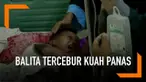 Ditinggal sang Ibu menyusuai adiknya seorang Balita tercebur ke dalam panci yang berisi kuah soto panas. Akibat tubuh sang Balita melepuh