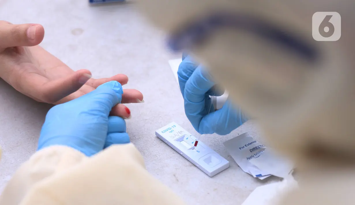 Petugas medis mengambil sempel darah warga saat Rapid Test Covid-19  dilakukan oleh Dinkes Provinsi Banten di Tangerang, Selasa (21/4/2020). Warga dapat melakukan isolasi mandiri setelah mengetahui hasil dari Rapid Test Covid-19 tersebut. (Liputan6.com/Angga Yuniar)