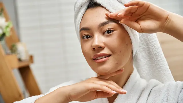 Meredakan Jerawat Kemerahan: Solusi Perawatan Tepat Wujudkan Wajah Mulus di Tahun 2025