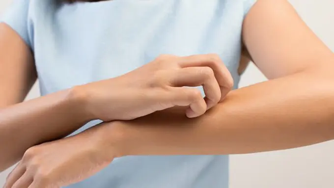 Alasan rentan digigit nyamuk/copyright Shutterstokc.com