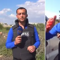 Usai melakukan pelaporan langsung, wajah wartawan ini terkena pecahan peluru meriam. Dia lantas langsung di bawa ke rumah sakit. 