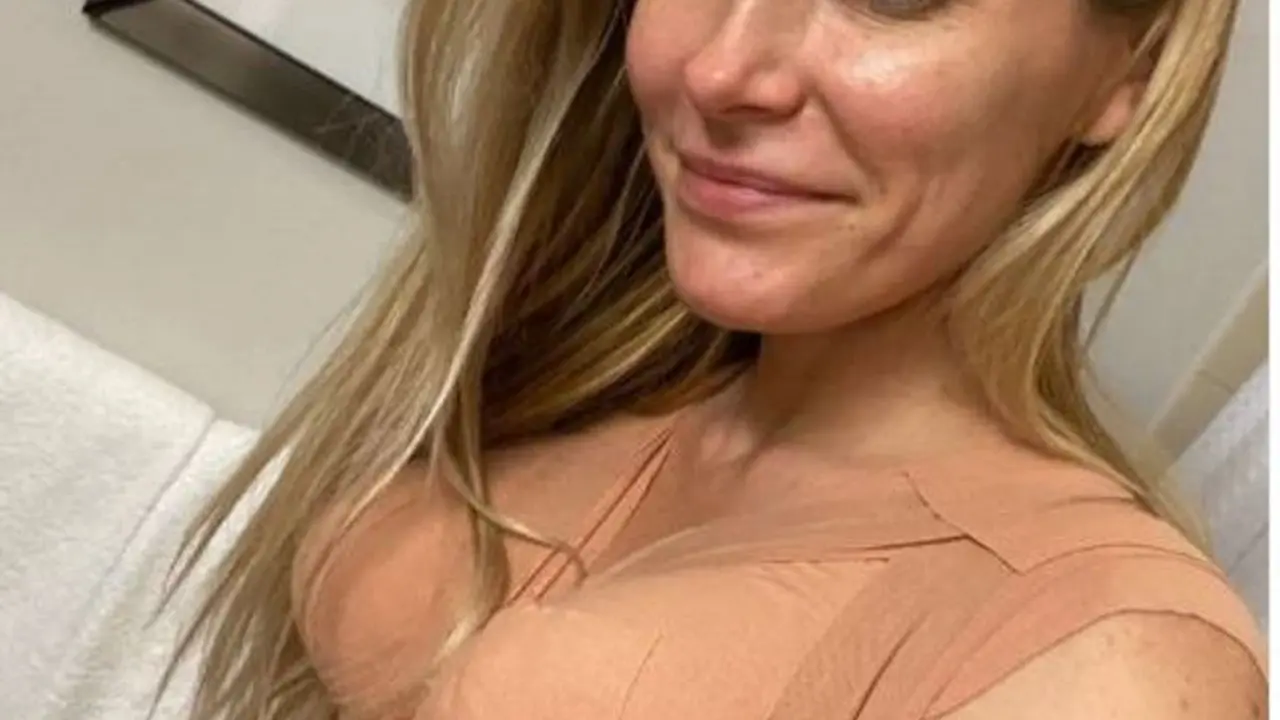 Nyaris Meninggal, Istri Mendiang Bos Playboy, Crystal Hefner, Kapok Jalani Operasi Kosmetik