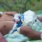 Bayi berkepala dua meninggal di Rumah Sakit Ibnu Sina, Gresik, Jawa Timur. (Liputan6.com/Dhimas Prasaja)