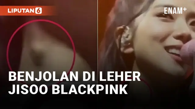 VIDEO: Ada Benjolan di Leher Jisoo Blackpink, Fans Khawatirkan Kesehatannya