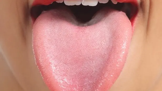 3 Hal Ini Terjadi Kalau Tak Bersihkan Lidahmu