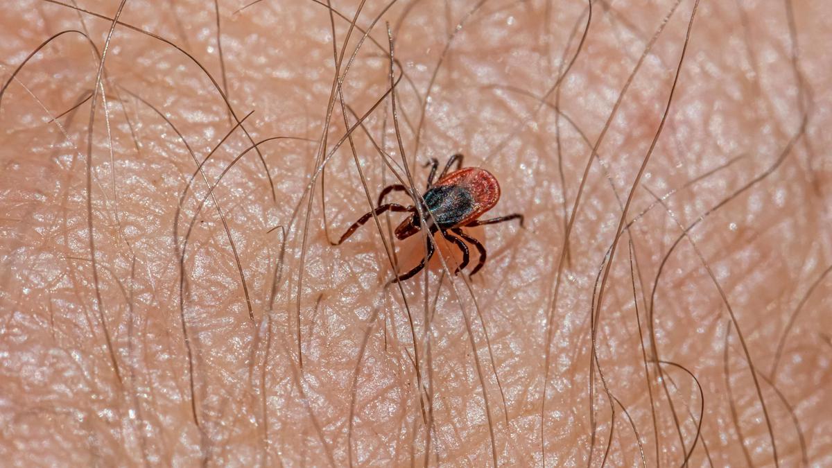 Dari Gigitan Kutu Bisa Sebabkan Penyakit Lyme, Apa Saja Tanda-Tandanya?