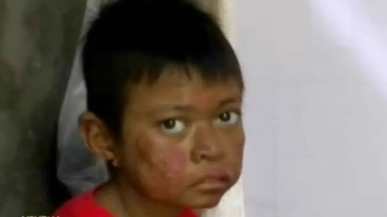 Bocah-Sakit-Diasingkan