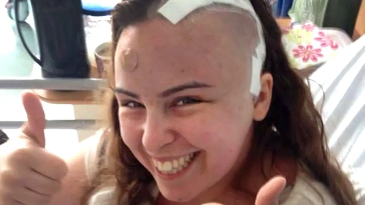 Migrain Parah, Wanita Ini Ternyata Terkena Tumor Otak