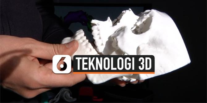 VIDEO: Teknologi 3D Bantu Proses Rekontruksi Wajah Seorang Pria