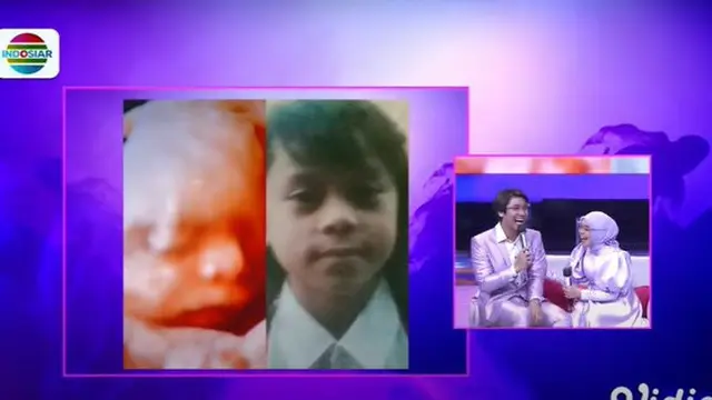 6 Potret Lesty Kejora Pamer Foto USG, Kini Usia Kandungan Sudah 6 Bulan