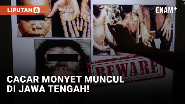 Cacar Monyet Ditemukan, Ganjar Pranowo Minta Penjagaan Diperketat