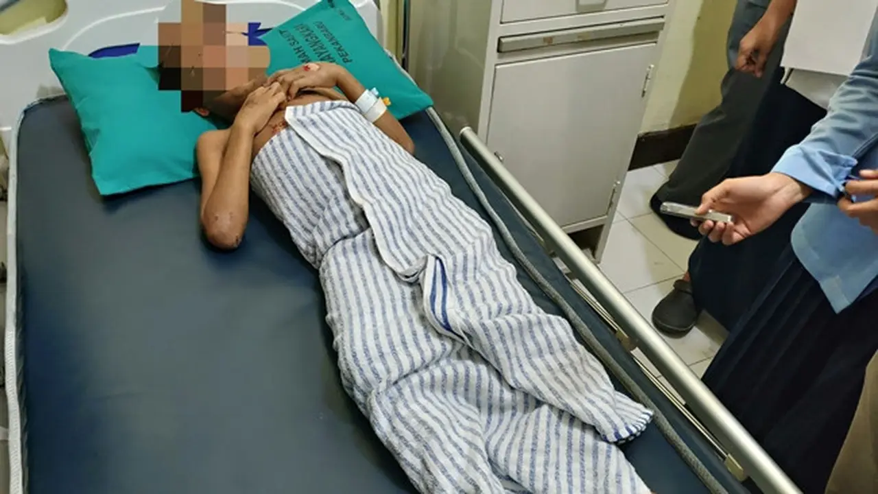 Bocah inisial R, korban penganiayaan sadis dirawat di ruang isolasi RS Bhayangkara Polda Riau.