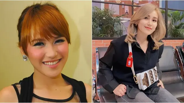 Bukan Oplas, Ini Transformasi 7 Penyanyi Dangdut yang Memesona Usai Tanam Benang