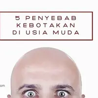 5 Penyebab Kebotakan di Usia Muda