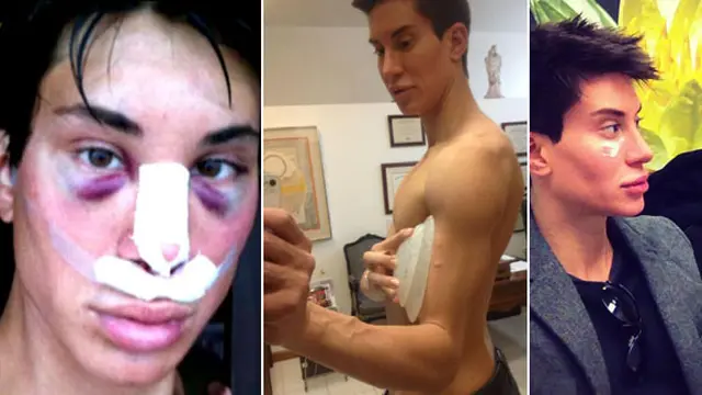 (c) facebook.com/Justin Jedlica 