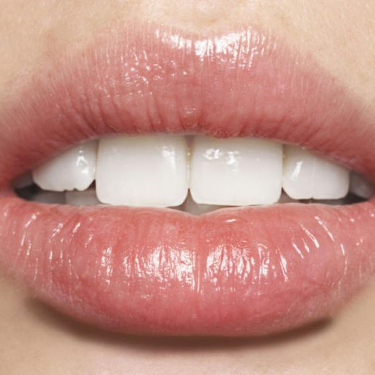 Белые губы у женщин