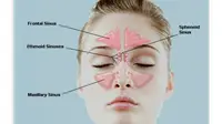 Sinus dan Sinusitis (sumber: WebMD)