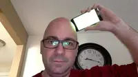 iPhone 6 Plus Bisa Sebabkan Kebotakan?