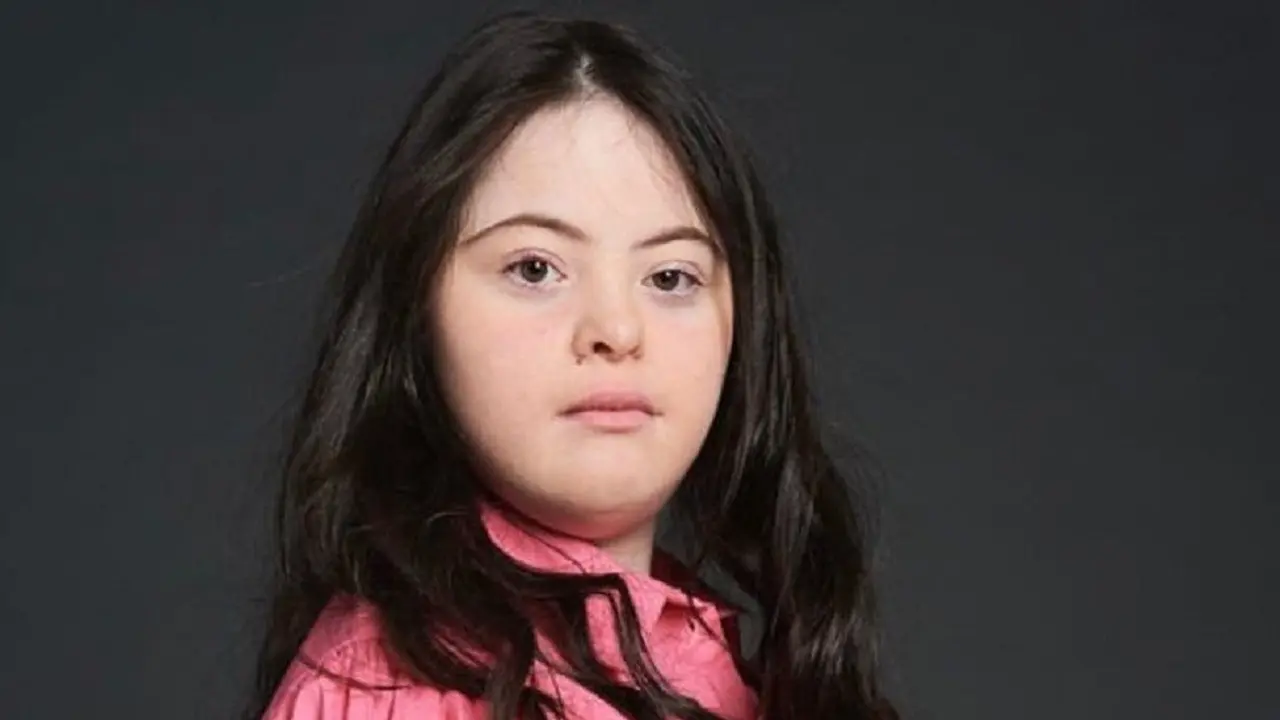 Ilustrasi down syndrome