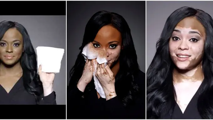 Photo copyright Youtube/ Dermablendpro