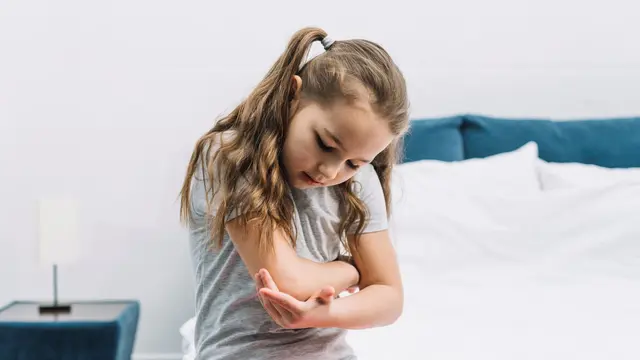 Kenali Cacar Air dan Herpes Zoster pada Anak, IDAI Tekankan Imunisasi Sejak Dini untuk Perlindungan Optimal