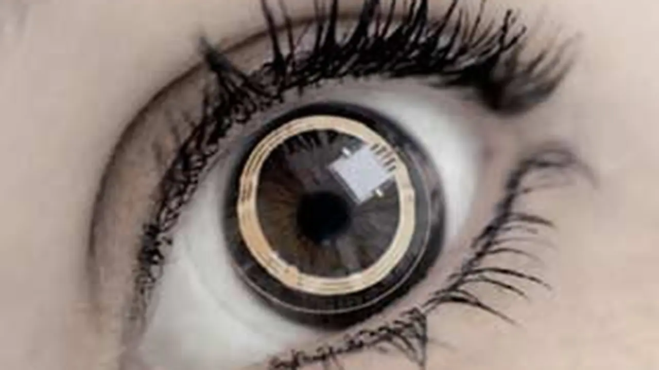 120205alensa-kontak.jpg