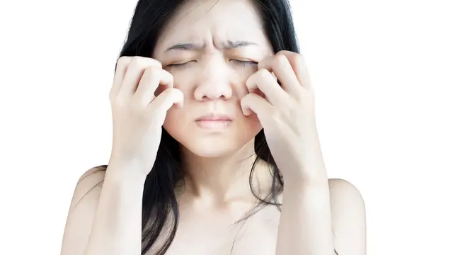 Kenali Beragam Alergi yang Bikin Wajah Gatal (HealthHappy HH/Shutterstock)
